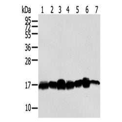 NME2 rabbit polyclonal antibody