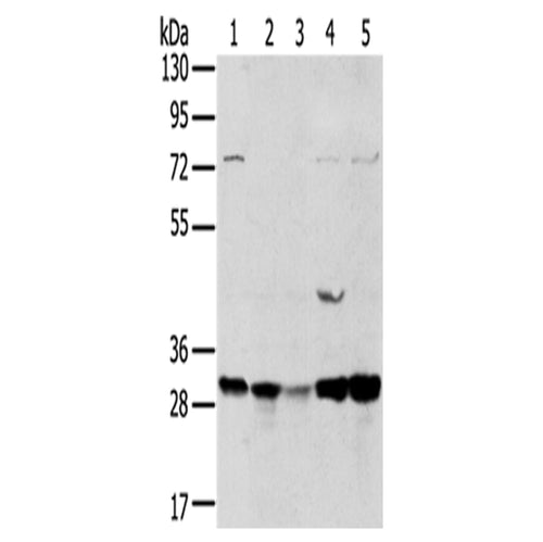 TPD52L2 rabbit polyclonal antibody
