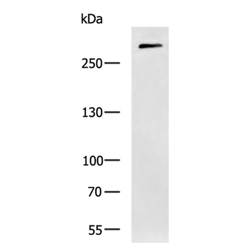 CSPG4 rabbit polyclonal antibody