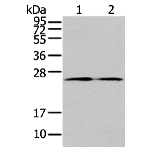 TUSC1 rabbit polyclonal antibody