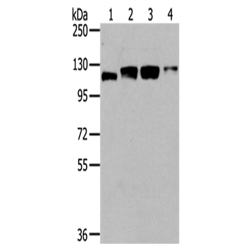 UBA1 rabbit polyclonal antibody