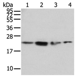 RAB2A rabbit polyclonal antibody