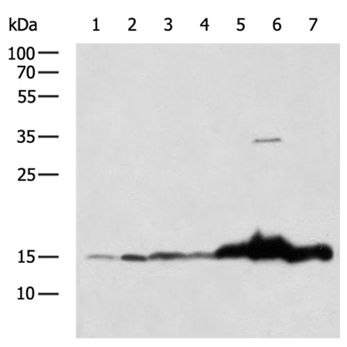 VAMP2 rabbit polyclonal antibody