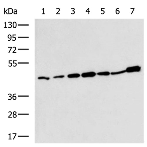 VPS4A rabbit polyclonal antibody