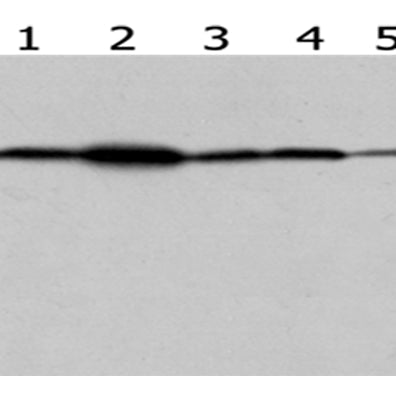 VPS26A rabbit polyclonal antibody