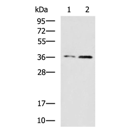 CBX7 rabbit polyclonal antibody