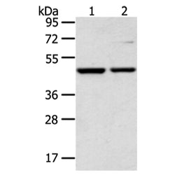 CTBP1 rabbit polyclonal antibody