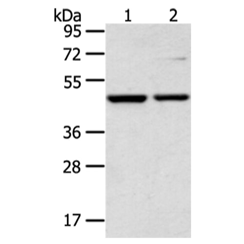 CTBP1 rabbit polyclonal antibody