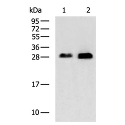 CALB2 rabbit polyclonal antibody