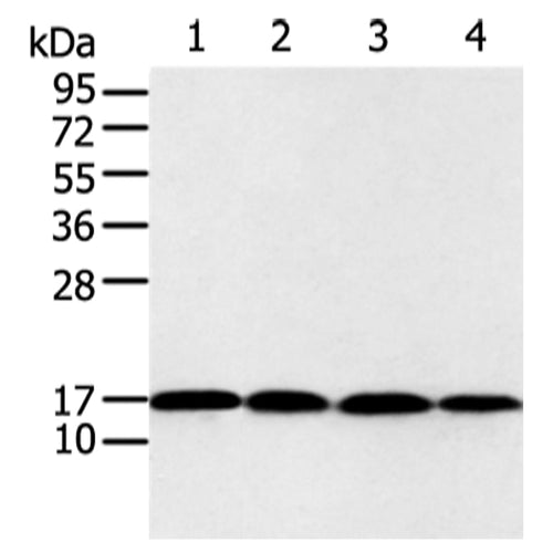 UBE2I rabbit polyclonal antibody