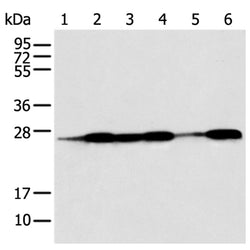 BAG2 rabbit polyclonal antibody