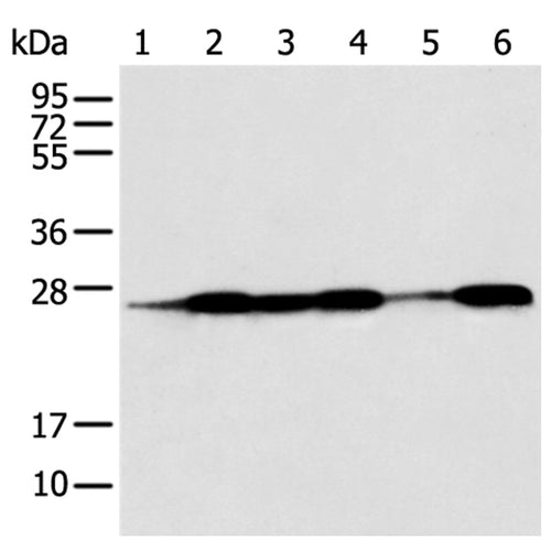 BAG2 rabbit polyclonal antibody