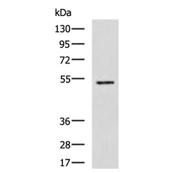 HTR2A rabbit polyclonal antibody