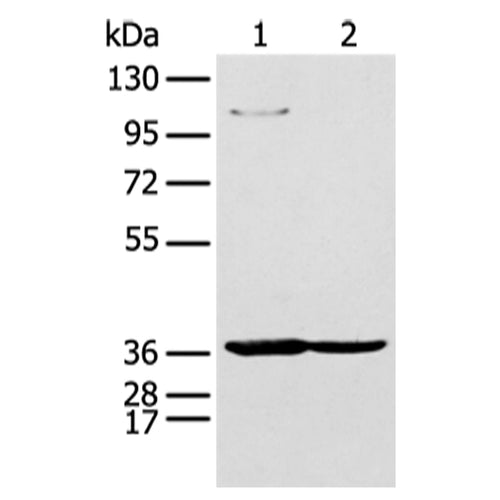 NUDT19 rabbit polyclonal antibody