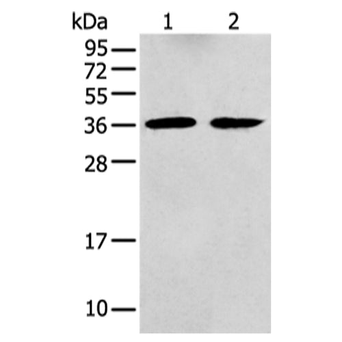 GNAI2 rabbit polyclonal antibody
