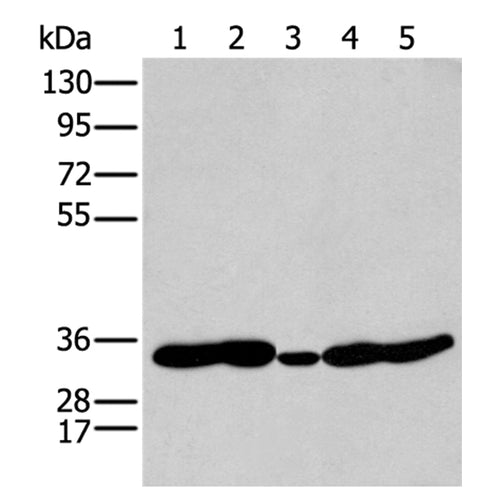 HOXC11 rabbit polyclonal antibody
