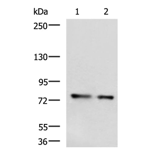 MEN1 rabbit polyclonal antibody