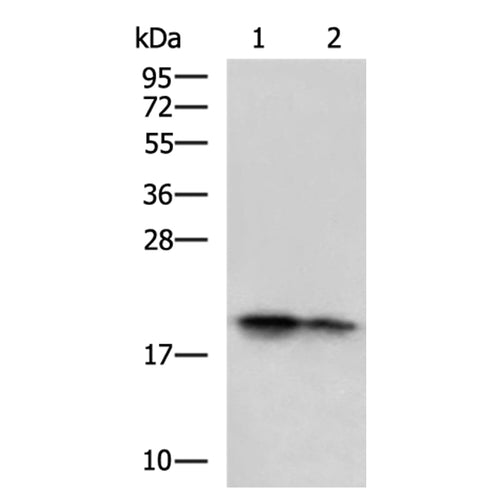 SST rabbit polyclonal antibody