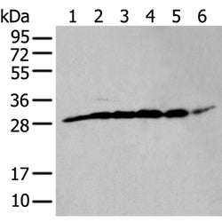ETFB rabbit polyclonal antibody