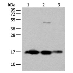SNCB rabbit polyclonal antibody