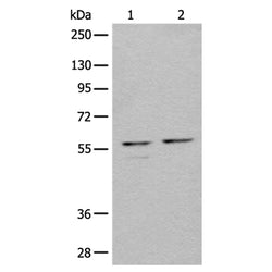 URI1 rabbit polyclonal antibody