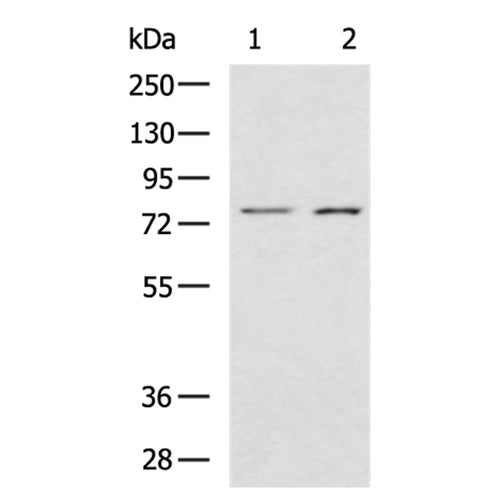 CAPN14 rabbit polyclonal antibody