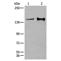 CAPN15 rabbit polyclonal antibody