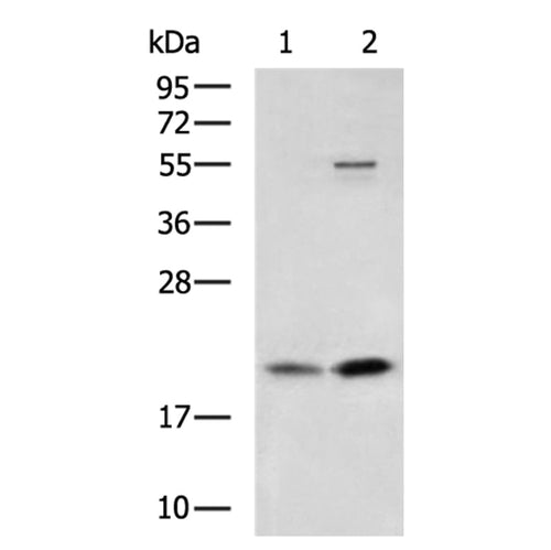FTL rabbit polyclonal antibody