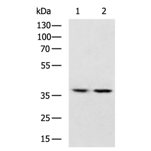 FBP2 rabbit polyclonal antibody
