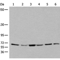 BBS10 rabbit polyclonal antibody