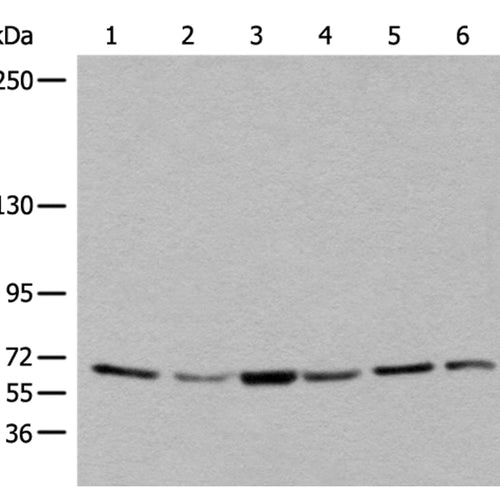 BBS10 rabbit polyclonal antibody