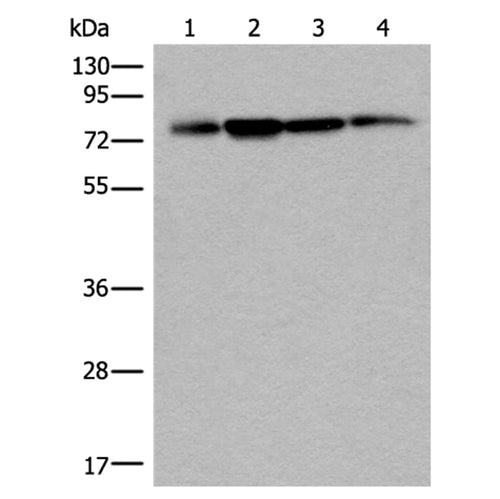 PHF21A rabbit polyclonal antibody