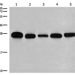 GATD3B rabbit polyclonal antibody