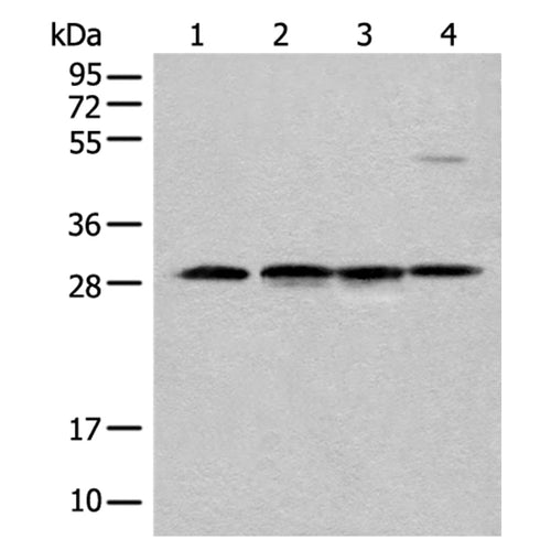 CA7 rabbit polyclonal antibody