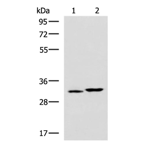 CBR3 rabbit polyclonal antibody