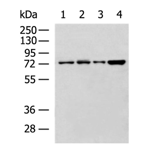 CCNK rabbit polyclonal antibody