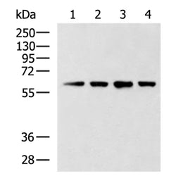 CCT6B rabbit polyclonal antibody