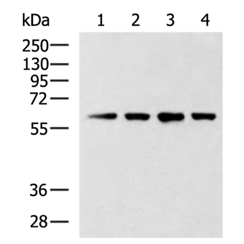 CCT6B rabbit polyclonal antibody