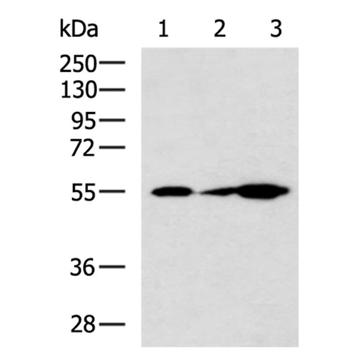 CDADC1 rabbit polyclonal antibody