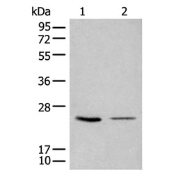 CDCA4 rabbit polyclonal antibody