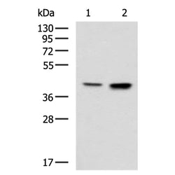 CSNK2A2 rabbit polyclonal antibody