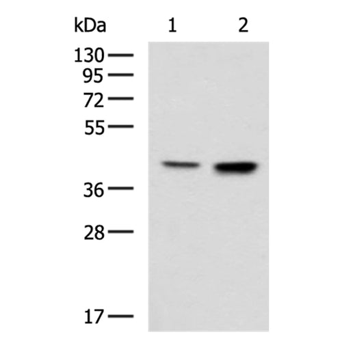 CSNK2A2 rabbit polyclonal antibody