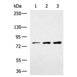 CLCN7 rabbit polyclonal antibody