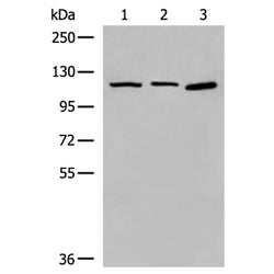 CORO7 rabbit polyclonal antibody