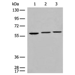 TKFC rabbit polyclonal antibody