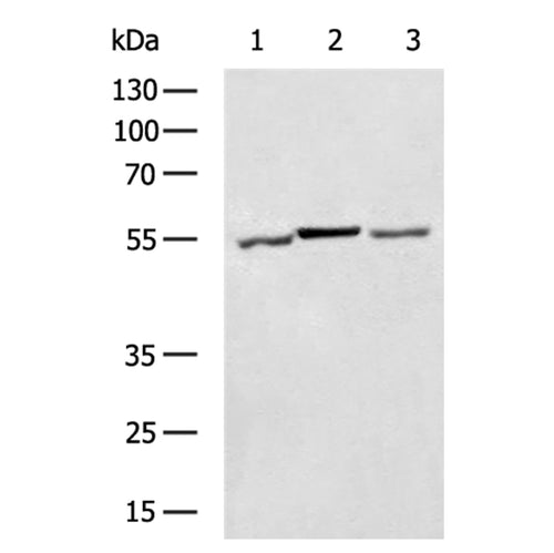 GSDME rabbit polyclonal antibody