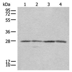 COMT rabbit polyclonal antibody