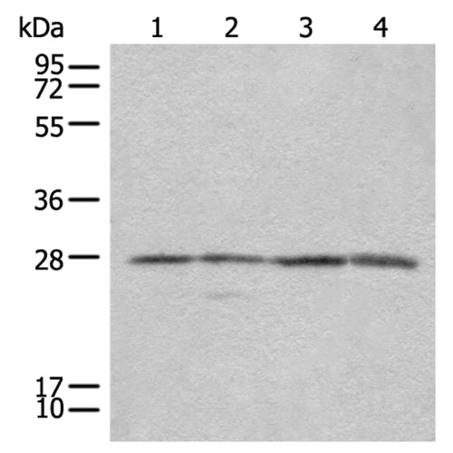 COMT rabbit polyclonal antibody