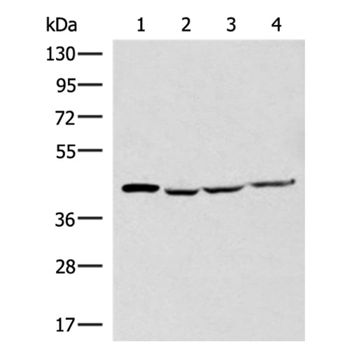 SLC16A7 rabbit polyclonal antibody