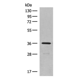 MTNR1A rabbit polyclonal antibody